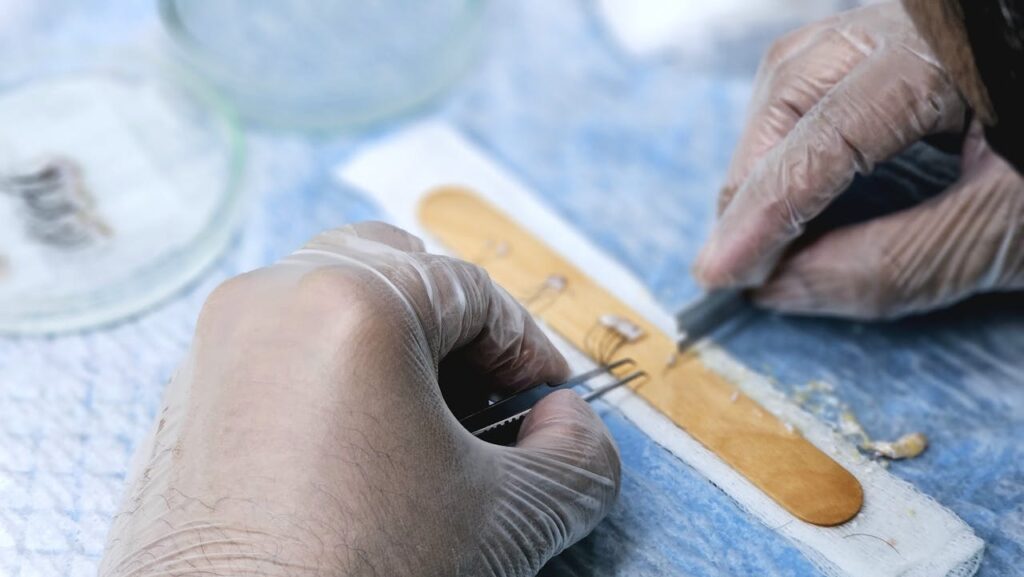 pexels-photo-27138343 Close-up of surgeons preparing hair grafts for transplantation, demonstrating precise skills.